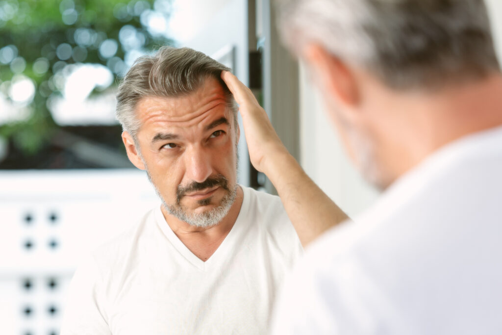 receding-thinning-freaking-out-lets-talk-male-pattern-hair-loss