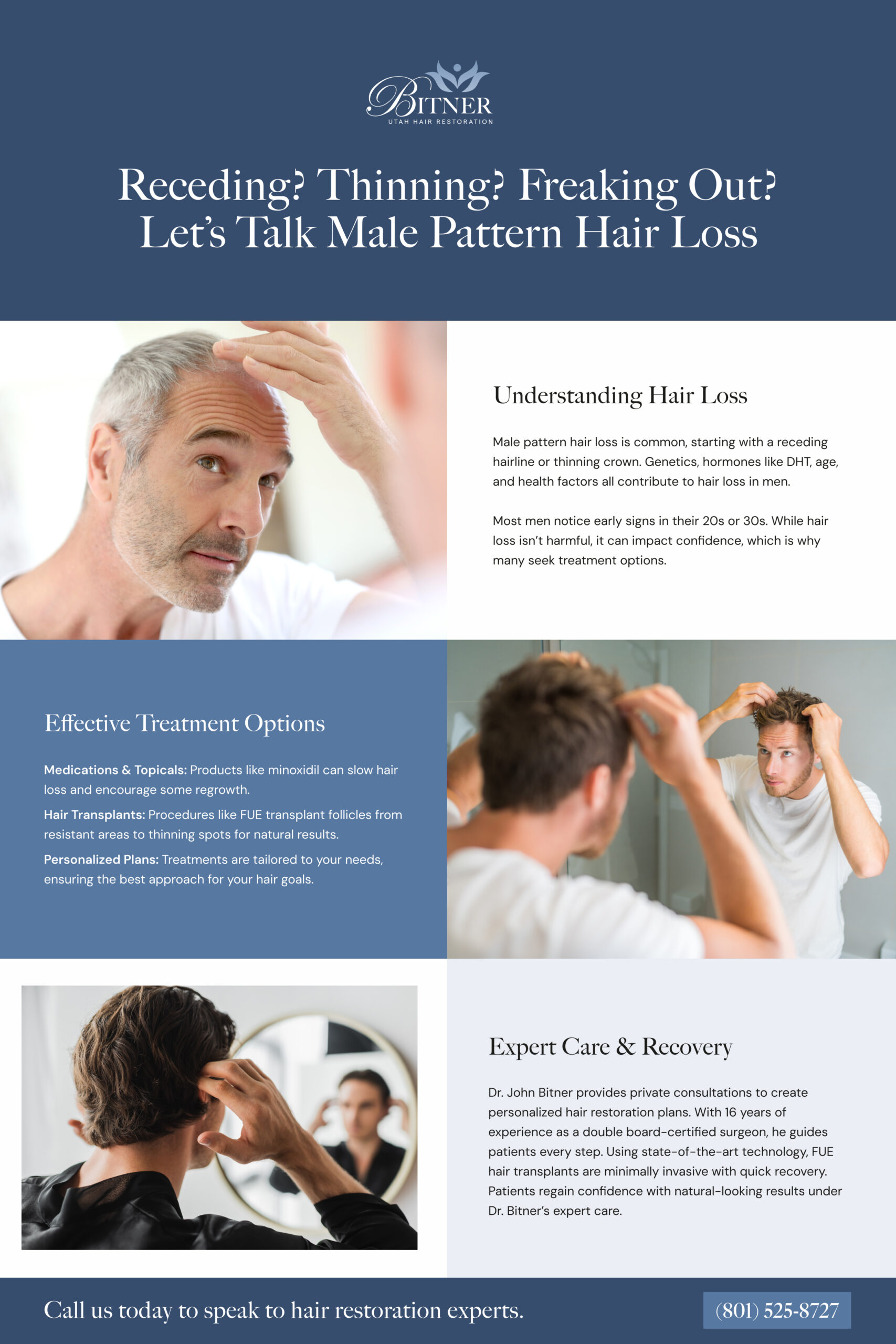 receding-thinning-freaking-out-lets-talk-male-pattern-hair-loss