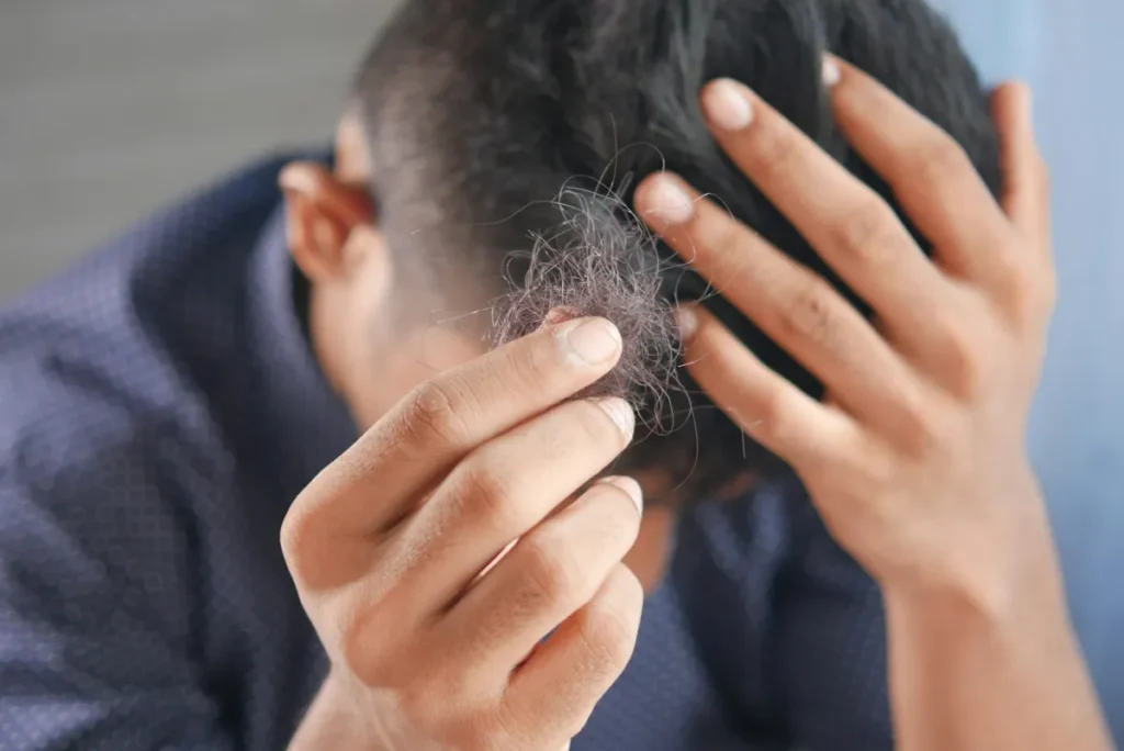 Man holding a few strands of shed hair while checking his thinning hair
