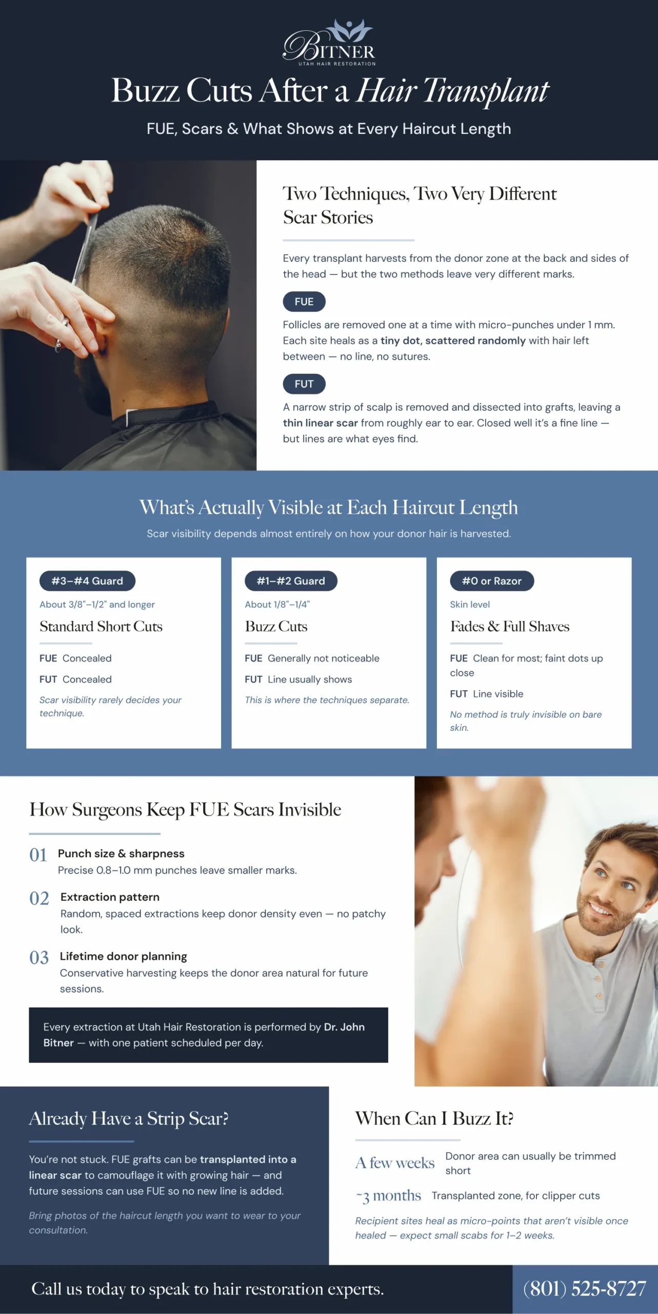 Infographic: buzz cuts after a hair transplant — how FUE and FUT donor scars differ, what shows at each haircut length, and when you can buzz your hair